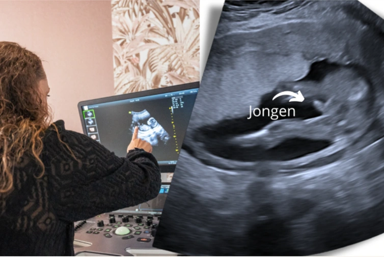 Pretecho geslachtsbepaling